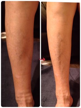 フットケアサロン ラビフット(Rabbi foot)/リフレでむくみ解消!