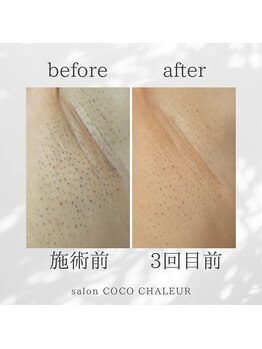 ココ シャルール(salon COCO CHALEUR)/Before　After