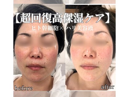シャラ(shara)の写真