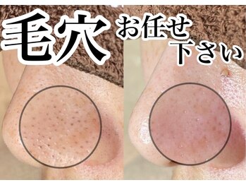 アンドピエル(AndPiel)/毛穴の悩み、お任せ下さい