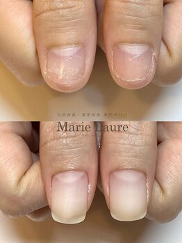 マリーロール 梅田店(Marie Laure)/自爪育成/深爪矯正/ネイルケア