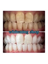 ホワイトニングショップ 所沢店/ホワイトニングショップ所沢店