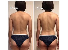 ココラーレ(cocorare)の雰囲気（新型痩身ハイパーナイフEXで！！少ない回数でもしっかり結果を◎）