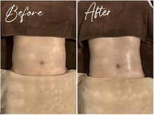 イリアス 藍住店(IRIAS)/before/after＊腸もみ