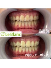 ルブラン 奈良店(Le Blanc)/歯出して笑っていませんか！？