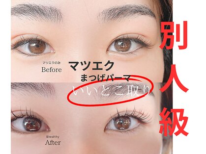 ミリー(miRii)の写真