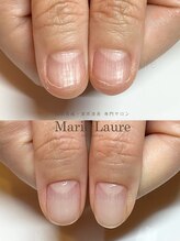 マリーロール 淀屋橋本店(Marie Laure)/自爪育成/深爪矯正/ネイルケア