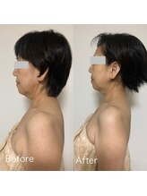 ルシアル(LUCIALL)/