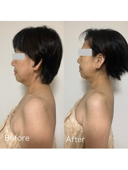 ルシアル(LUCIALL)/