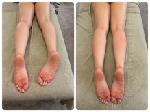 ココロ(COCO.RO)/足の重だるさ我慢していませんか