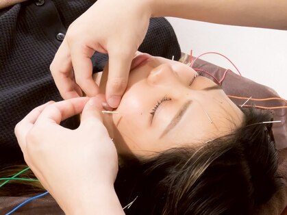 まつば鍼灸整骨院の写真