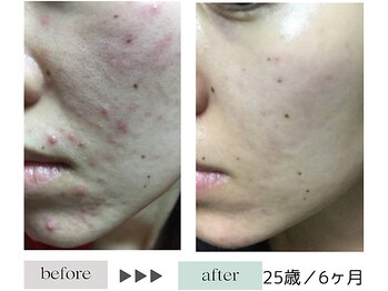 ハイケア グラン ギンザ(HYCARE GRAND GINZA)/日本ーの肌改善サロン実力/銀座