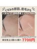 【満足度 人気No.1】素肌美人に育てるフェイスワックス脱毛