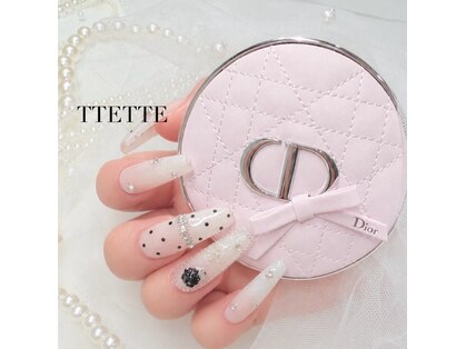 テッテ(TTETTE)の写真