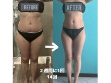 トータルビューティーアンドウィズ(total beauty&WITH)/お客様の理想ボディへ