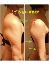 ビューティースパ/【7回】二の腕凸凹セル脂肪撃退!