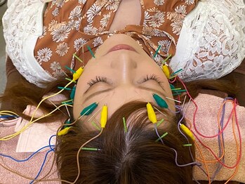 チキバン美容鍼灸整体サロン 心斎橋店/美容鍼プレミアム