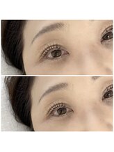 ポタラ(Potala)/ダメージレスラッシュリフト