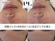 プルスキンサロン 大阪店(pull skin salon)/