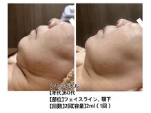 クレビア 神保町 水道橋(CREBIA)の雰囲気（話題のレモンボトルで半永久的に脂肪を分解！！）