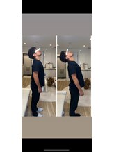 整体アイリス バイ ココイロ(IRIS by COCOIRO)/ビフォーアフター