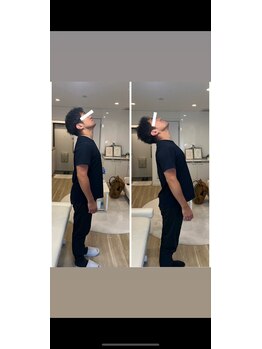 整体アイリス バイ ココイロ(IRIS by COCOIRO)/ビフォーアフター