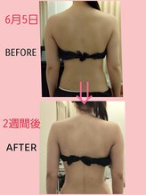 マールム(MALUM)/ブライダル ケア