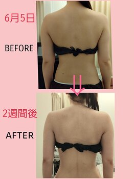 マールム(MALUM)/ブライダル ケア