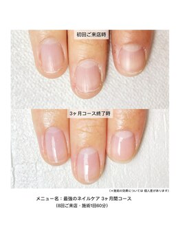 ネイルサロン ラピエトラ(la pietra)/最強のネイルケア3ケ月間コース