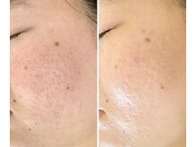 スリリアン 銀座/★お客さまビフォーアフター★