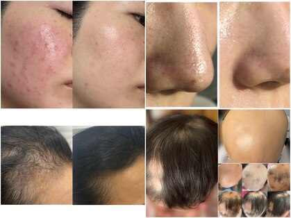 レアリゼ(REALISER)の写真