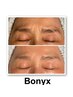 【初回半額】メディカル発想塗るボ〇ックス《Bonyx》シワ改善