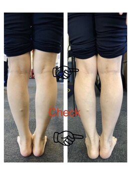 カイロプラクティックサロン 伝々夢志/脚の冷え、むくみでお悩みのかた