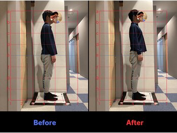 栄光治院 岡崎南院/#猫背矯正 #整体 #姿勢 #岡崎