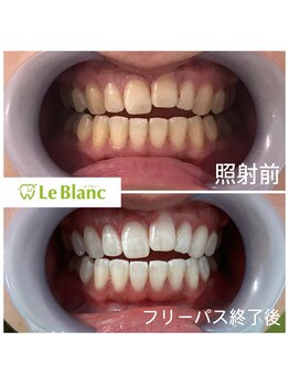 ルブラン 奈良店(Le Blanc)/沢山通ってお得に！