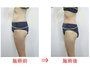 東京美容整体/ダイエット痩身 20代女性