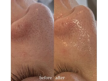 リーミー(Re:me)/★1度で効果がわかると大好評中