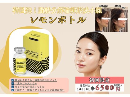 ティー(T)の写真