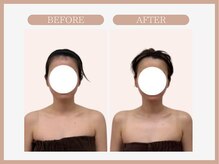 スリムライン 盛岡店(The Slim Line)/before→after