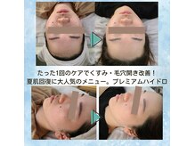 自分の肌に合った「パーソナルコース」が大人気！細胞から再起動