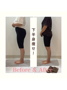 スタイルラボ高松/産後の骨盤矯正の効果♪