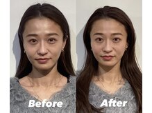 コルミチョン サロン(骨美整 salon)/Before・After