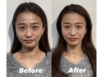 コルミチョン サロン(骨美整 salon)/Before・After