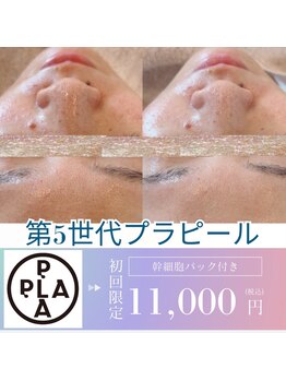 エミア(Emia)/韓国発☆プラチナプラピール