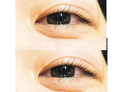 シェーン(schon)の写真