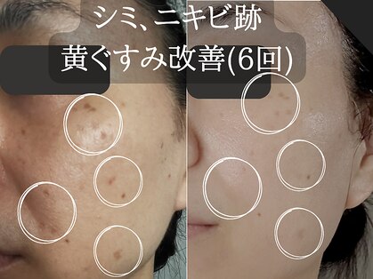 ミトラ(MITRA)の写真