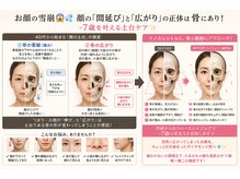 ラウレア(Laule'a)/顔の崩れを正しく戻す土台ケア