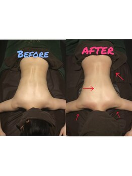 ヴィアス(Vias)/サイズダウンコース♪