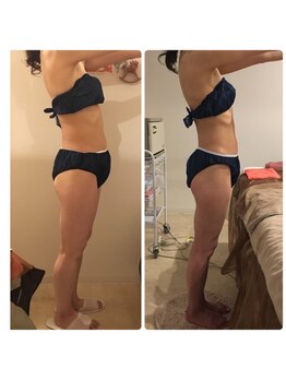 アンリール/ポッコリお腹解消