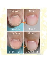 オンシジューム(Oncidium)/自爪育成中【2ヶ月の変化】